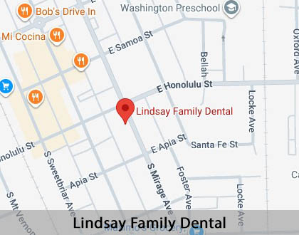 Map image for Pediatric Dentist in Lindsay, CA