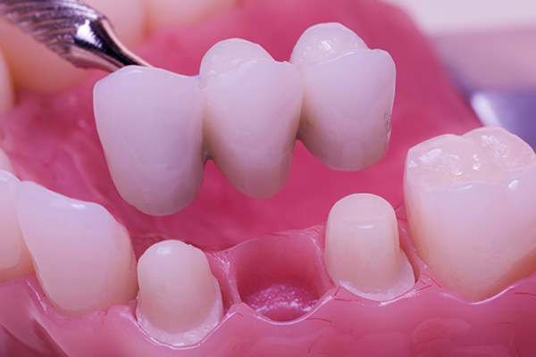 What To Expect During Teeth Extraction?