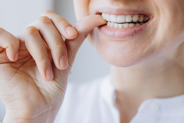 How Mouth Guards Can Protect Your Teeth While Playing Sports