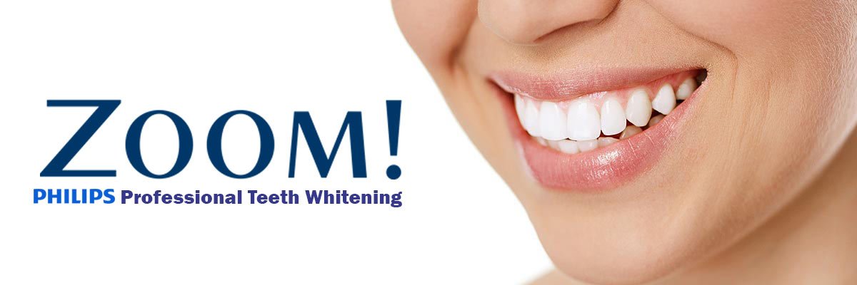 Lindsay Zoom Teeth Whitening